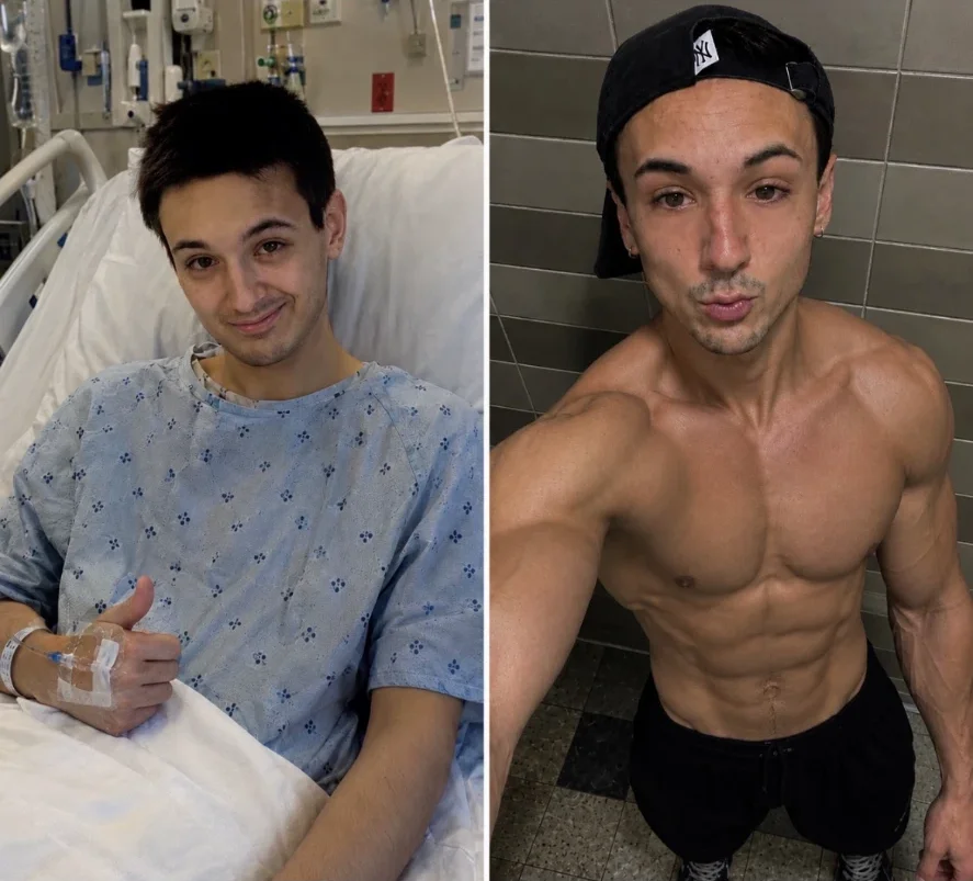 Meach in a hospital bed giving a thumbs up, beside a later photo of him lean and muscular